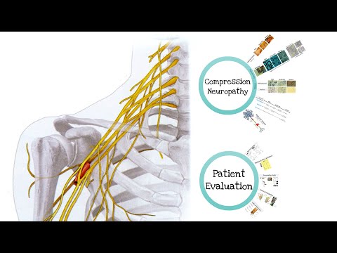 Wstęp do neuropatii uciskowych