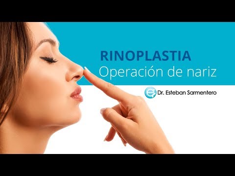 Rinoplastia - Doctor Sarmentero