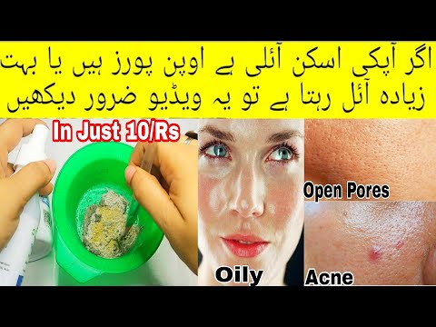Open Pores, Acne & Oil Control Daily Skincare Routine 100% Working