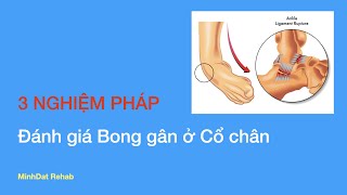 3 nghiệm pháp đánh giá bong gân ở cổ chân