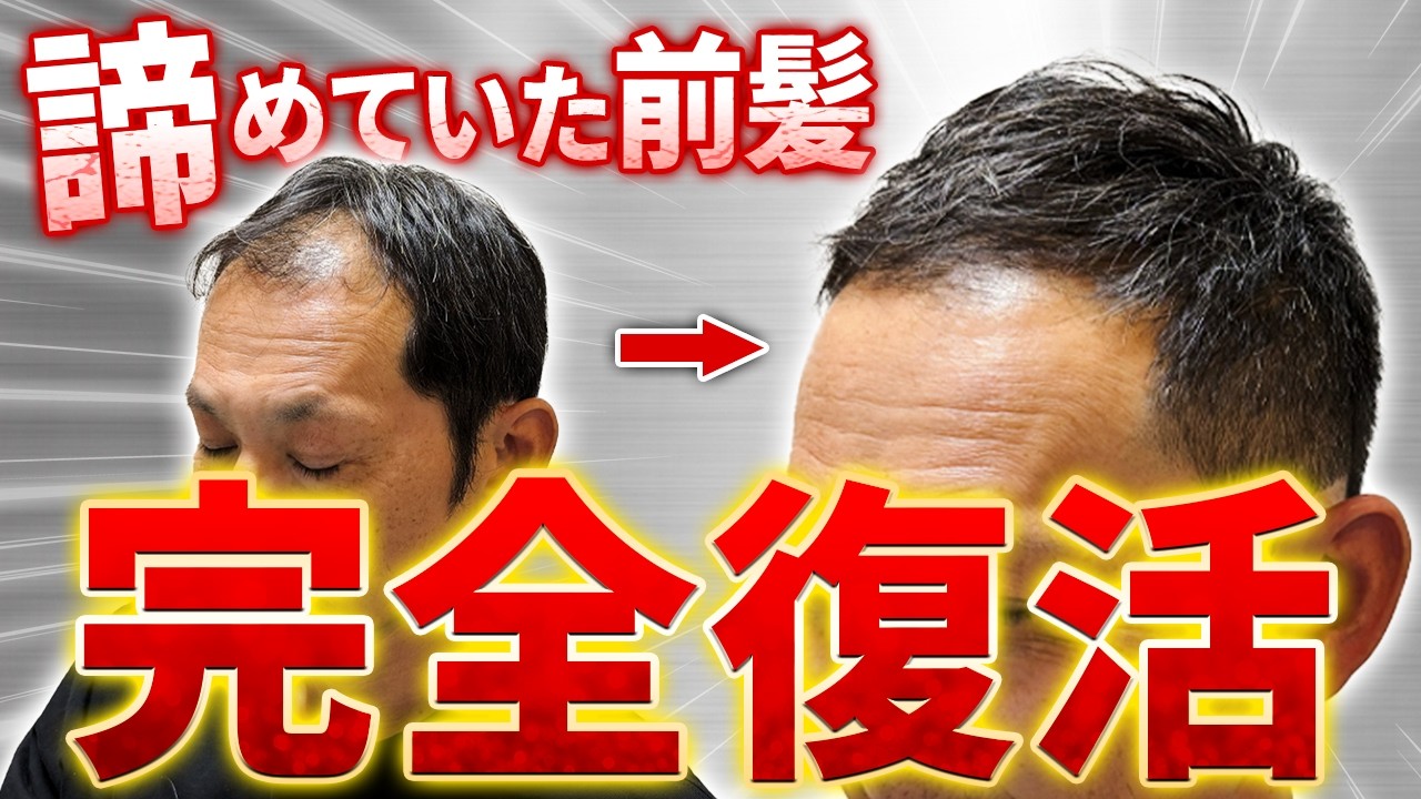 【前髪ハゲ】本当は短くしたいけど薄毛が気になって切れないモデルさん。全体的なバランスを整えつつ前髪を復活させるセット術をレクチャー