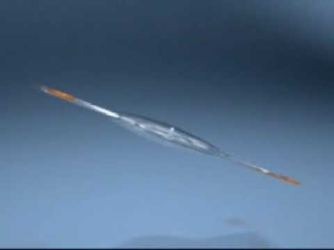 Crystalens® See Near, See Far