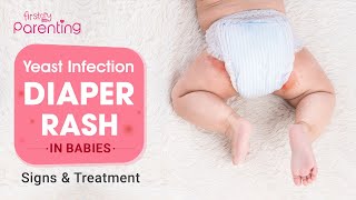 Yeast Infection Diaper Rash in Babies - Causes and Remedies