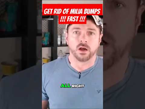 MILIA CURE? Get Rid Of White Skin Bumps