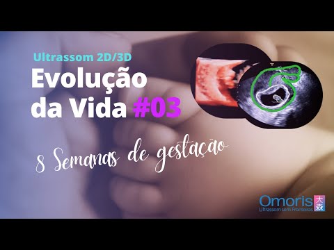 Gravidez semana a semana AO VIVO - Ultrassom 8 semanas - Evolução da Vida #03