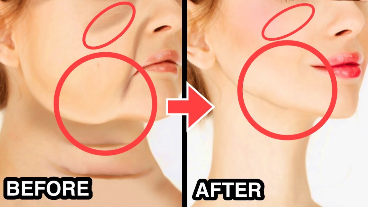 30mins🔥 Full Face Lifting Exercise for Sagging Jowls, Cheeks, Laugh Lines, Eye Bags