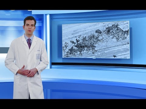 Dr. Weigert tutorial - specific prevention of chloride-induced pitting corrosion