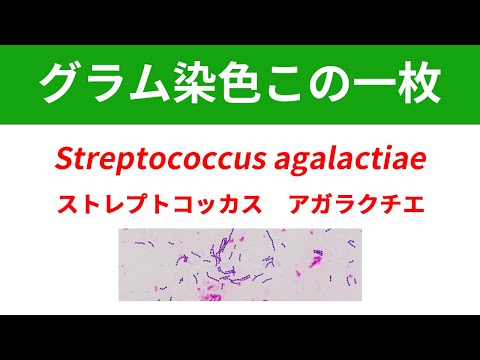 看護学科 今日のグラム染色この一枚 Streptococcus agalactiaeによる菌血症