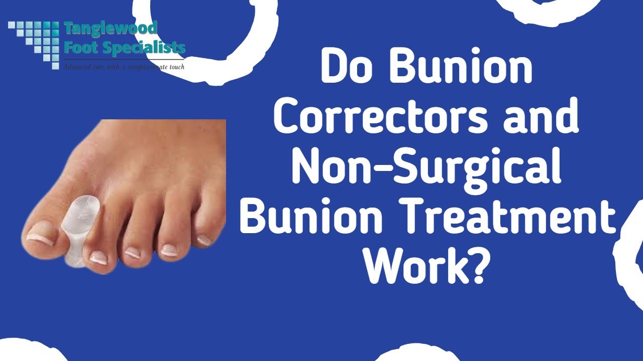 Driving after Bunion Surgery Houston bunion specialist Tanglewood