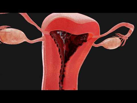 Der Menstruationszyklus | Animation
