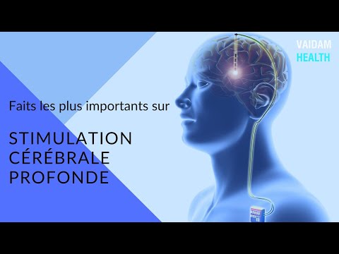 Stimulation cérébrale profonde