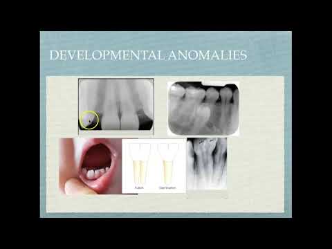 Radiologiczna interpretacja materiałów stomatologicznych oraz chorób i patologicznych objawów w jamie ustnej