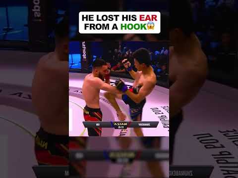 How this Fighter Lost His Ear During The MMA Fight?