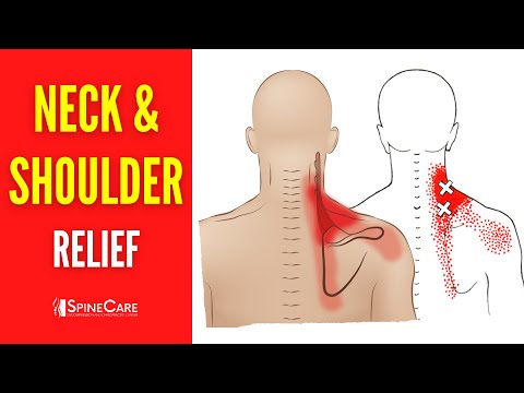How to Fix Neck and Shoulder Pain FOR GOOD