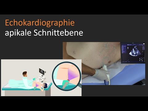 apikale Schnittebene - Echokardiographie