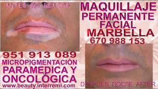 Tratamiento Del Vitiligo Anti Vitiligo Cura para el Vitiligo cura para vitiligo,