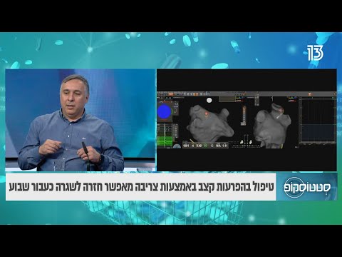הטכנולוגיות החדשות שכדאי להכיר בטיפול בפרפור פרוזדורים