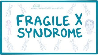 Fragile X Syndrome Explained