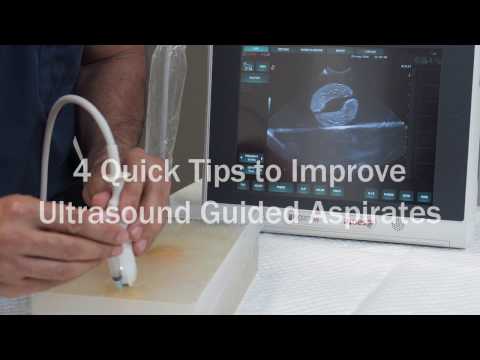 4 quick tips to improve ultrasound guided aspirates