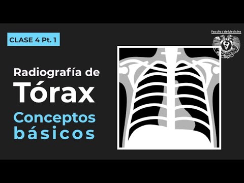 04.1 - Chest - Normal chest x-ray