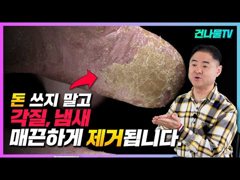 발 냄새, 각질 제거 돈 안 쓰고 한번 하면 제거