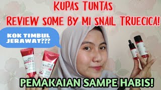 Download lagu #KUPASTUNTAS REVIEW SOME BY MI SNAIL TRUECICA MIRACLE REPAIR , PEMAKAIAN SAMPE HBS!!! mp3 Download lagu #KUPASTUNTAS REVIEW SOME BY MI SNAIL TRUECICA MIRACLE REPAIR , PEMAKAIAN SAMPE HBS!!! mp3