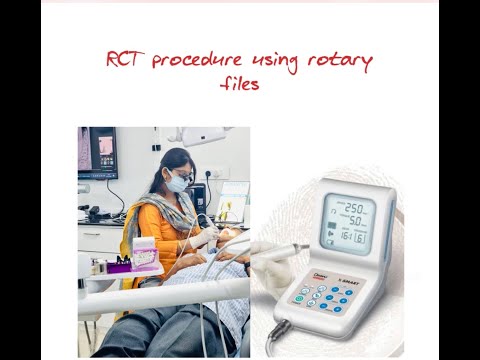 How to Perform a Rotary Endodontics Procedure: A Biomechanical Preparation Guide