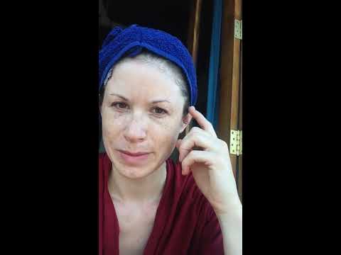 10.5.2016 Treatment Video