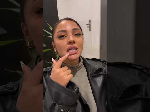 Le 1e grillz de Wejdene 💎🦷