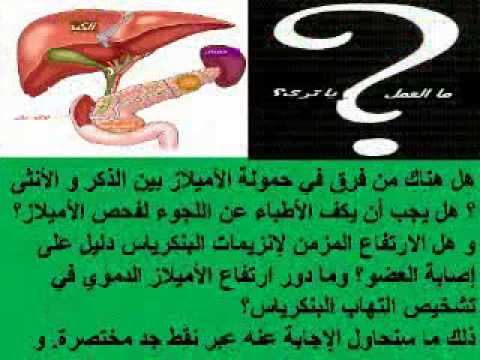 comment guerir une pancreatite aigue