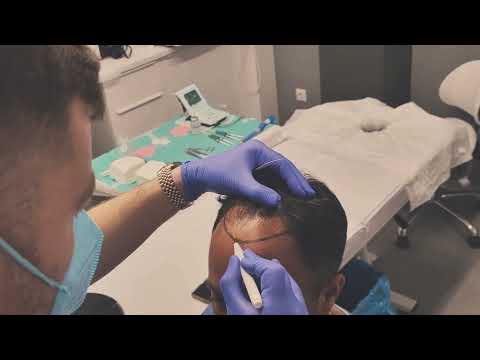 !CHOIEXPERT - Procedure Presentation in 20sec