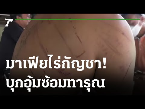 ซ่อม