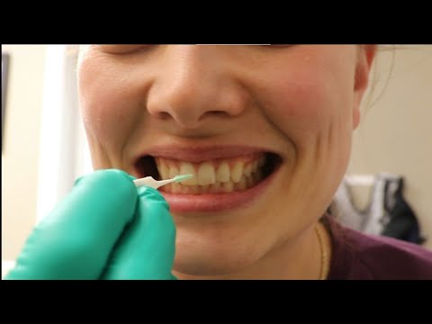 How to Properly Use a Soft Pick