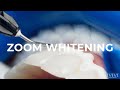 416 dentistry zoom whitening step by step procedure and before u0026 after