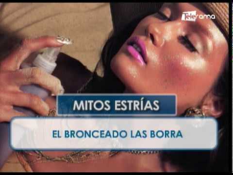 Mitos sobre las estrías 