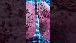 Download lagu Second-Hand Smoke: The Silent Health Threat mp3