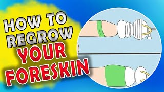 Foreskin Restoration: How to Regrow your Foreskin