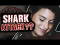 Experts Have NEVER Seen A Shark Attack Like This - The Strange Story Of Michelle Von Emster