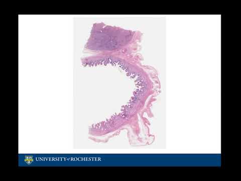 Histology of the Gallbladder