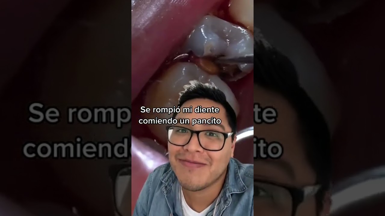 Me duele la muela al masticar 😭