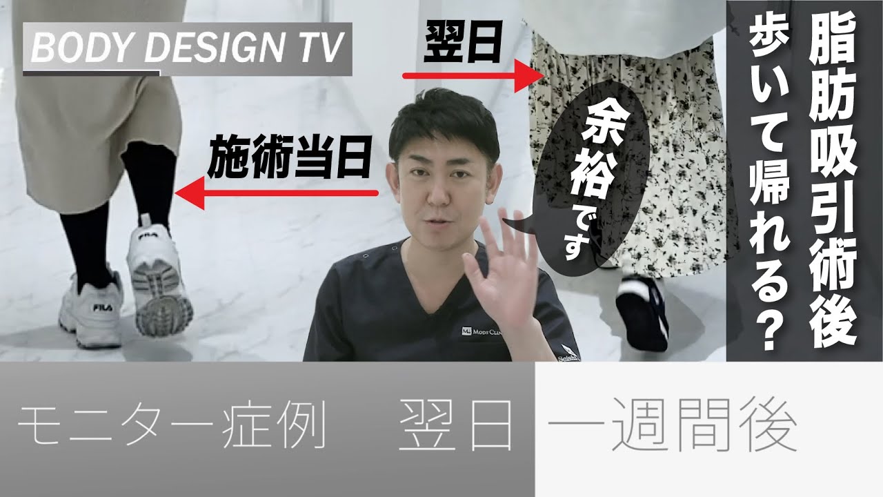 （太もも全周の脂肪吸引）術後、歩いて帰れますか？