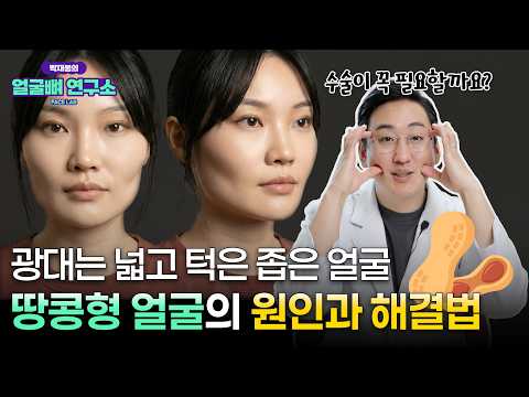 땅콩형 얼굴 윤곽수술 하면 해결될 수 있을까? 원인부터 해결법까지 총정리