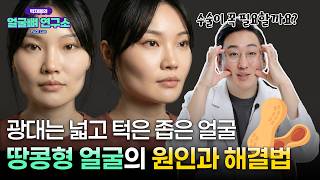 땅콩형 얼굴 윤곽수술 하면 해결될 수 있을까? 원인부터 해결법까지 총정리
