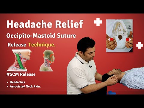 1ST RIB REFLEX RELEASE TECHNIQUE FOR THORACIC OUTLET SYNDROME NECK SHOULDER PAIN