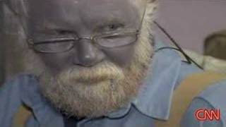 The Dangers of Colloidal Silver