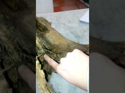 Smettere di legamenti dellanca Quali esercizi aiuto con il mal di schiena