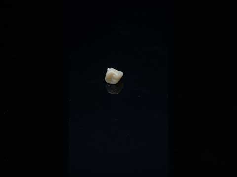 YouTube 썸네일
