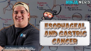 Esophageal and Gastric Cancer | Clinical Medicine