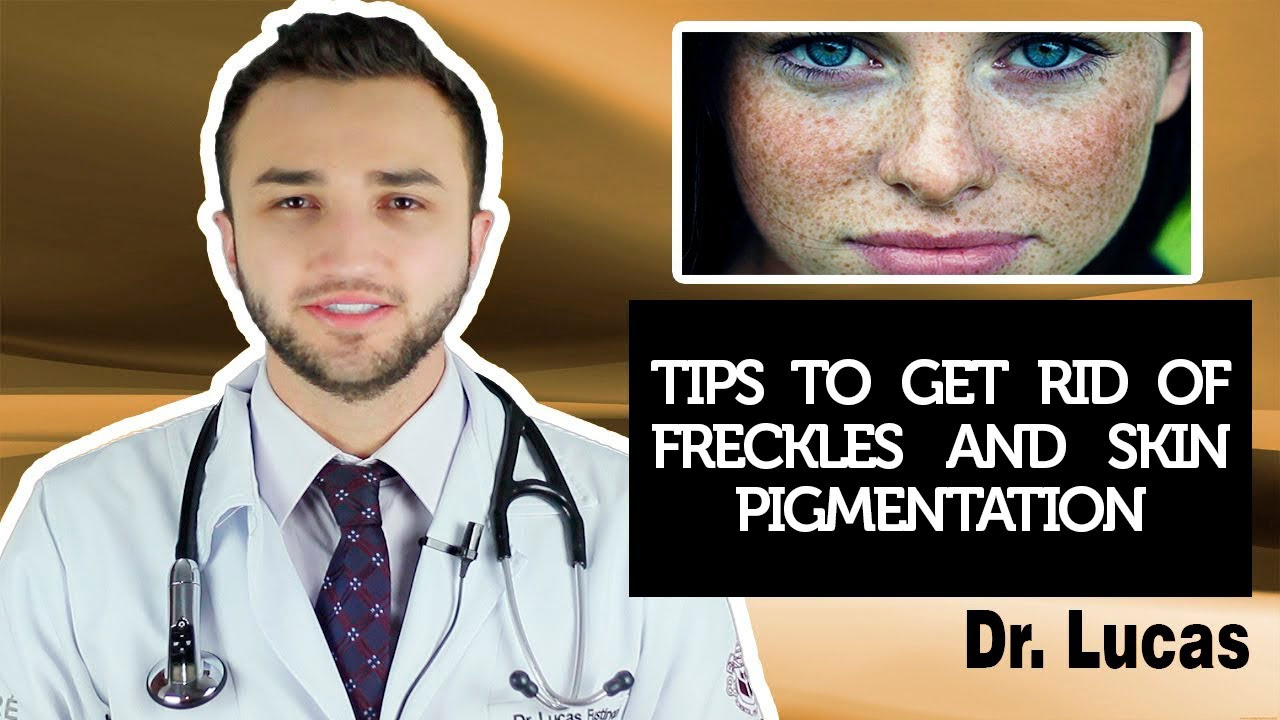 Tips to get rid of freckles and skin pigmentation - Dr Lucas Fustinoni Brazil
