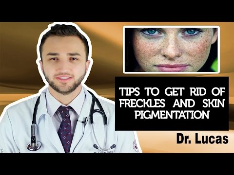 Tips to get rid of freckles and skin pigmentation - Dr ...